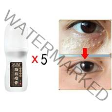 5p 비립종 얼굴 물 사마귀 편평사마귀 눈 눈가 눈밑 아그네스 한관종, 50ml, 5개