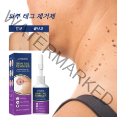 사마귀치료 사마귀제거 티눈 제거 복구 무통 세럼 제거액 20ml